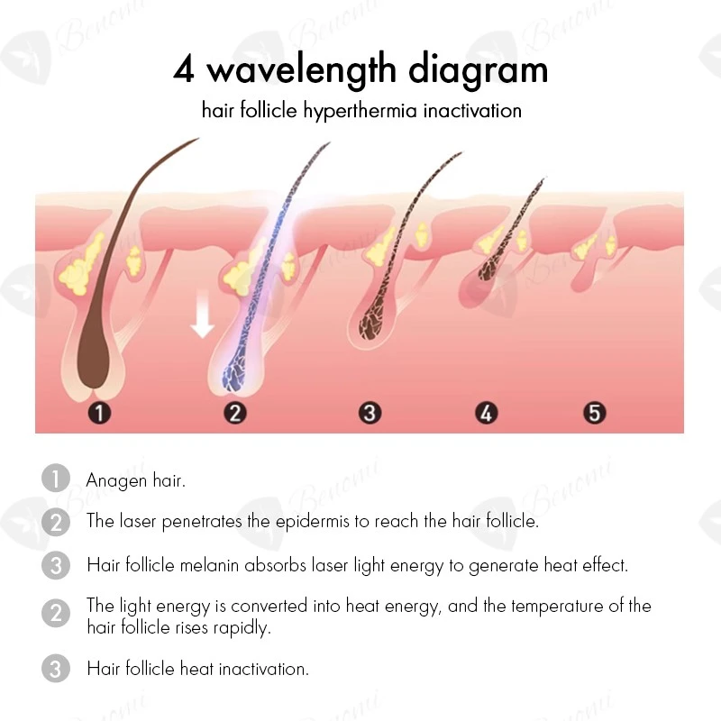 4 Wavelength Diode Laser